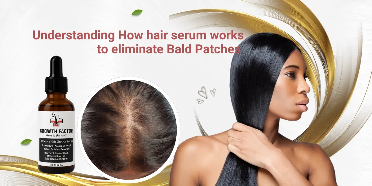 Understanding How hair serum works to eliminate Bald Patches